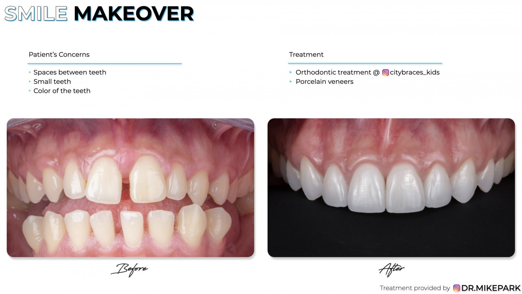 Clear-Dental_Before-and-After_002