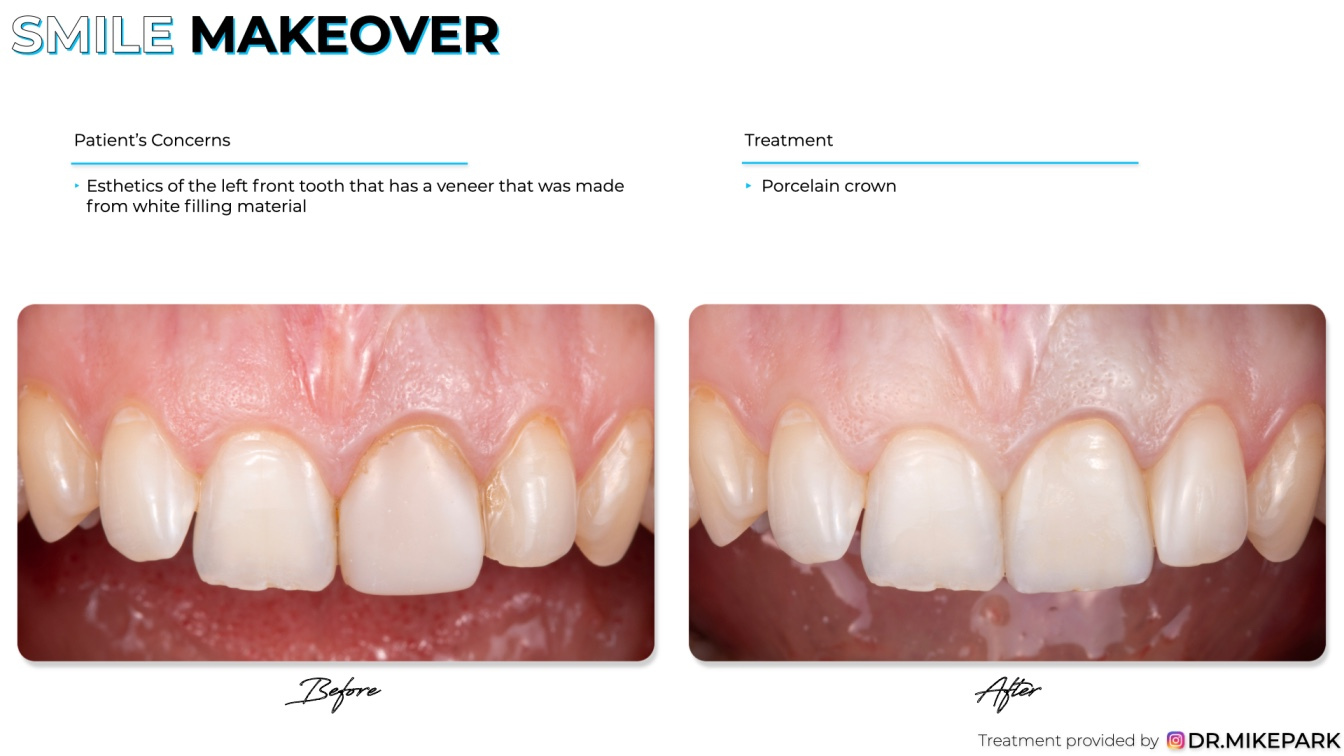 Clear-Dental_Before-and-After_003