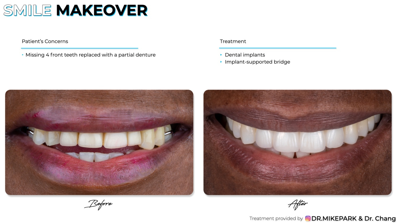 Clear-Dental_Before-and-After_005