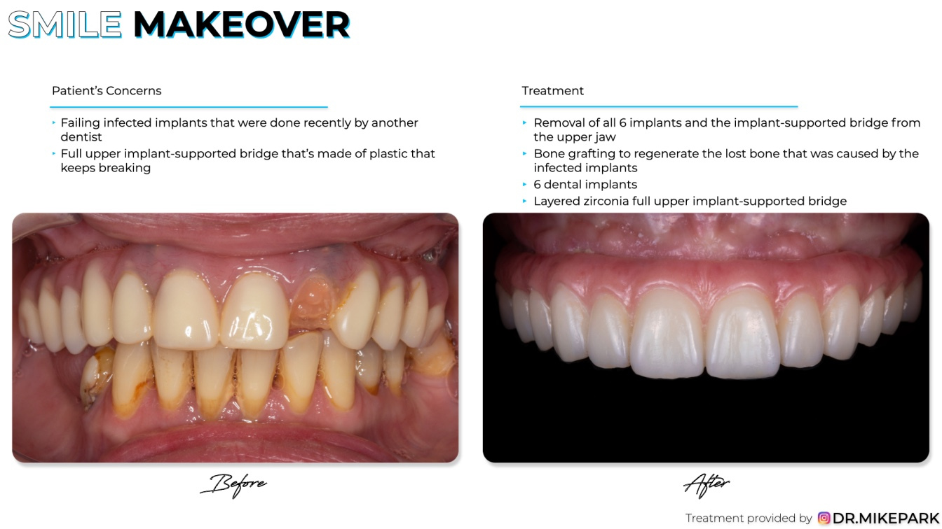 Clear-Dental_Before-and-After_014