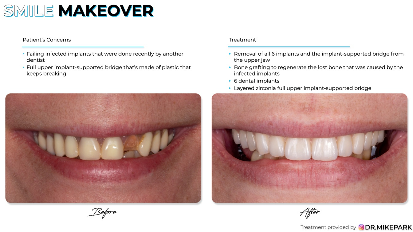 Clear-Dental_Before-and-After_015