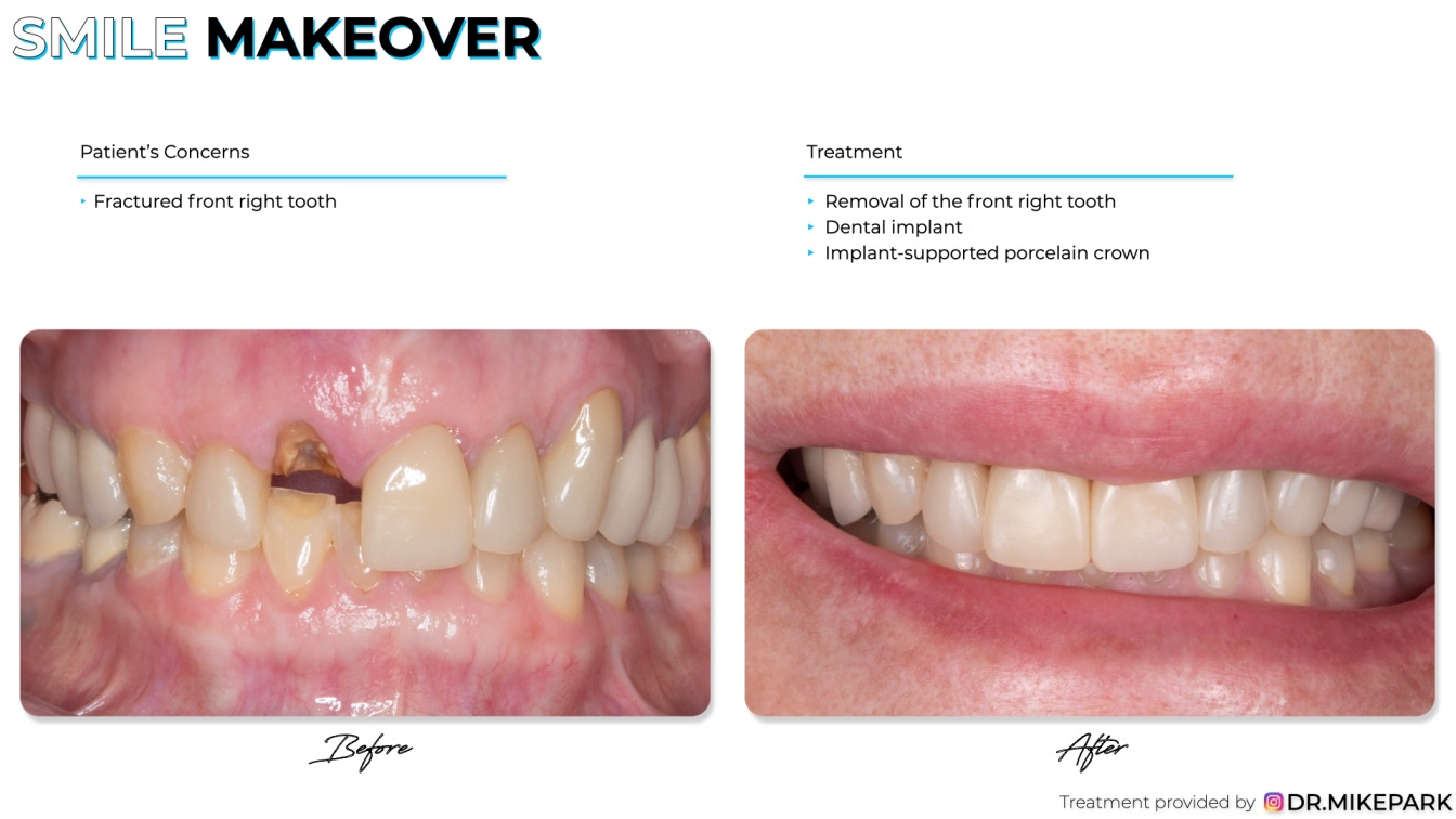 Clear-Dental_Before-and-After_016