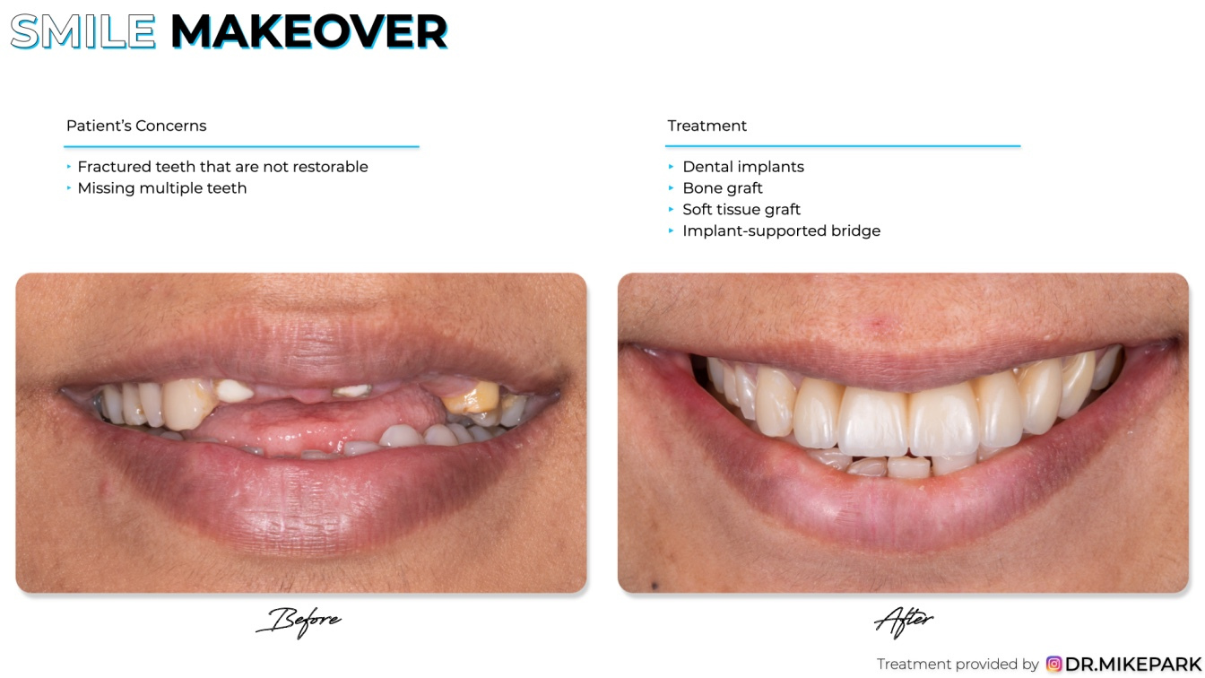 Clear-Dental_Before-and-After_017