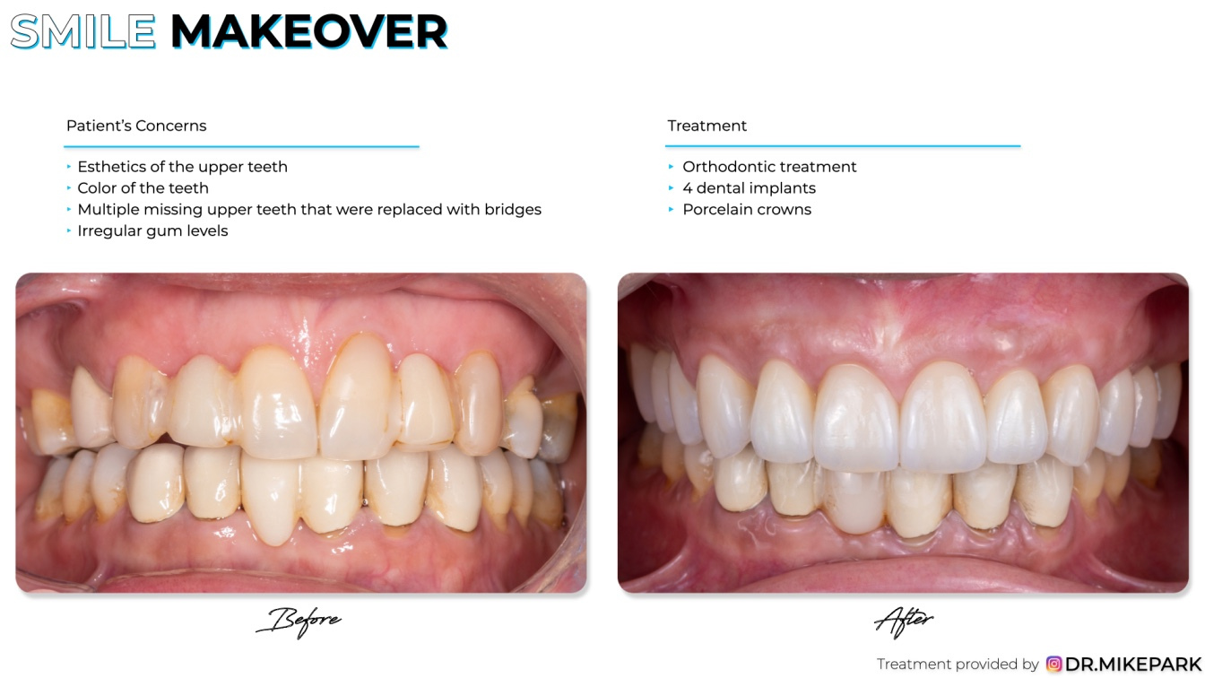 Clear-Dental_Before-and-After_018