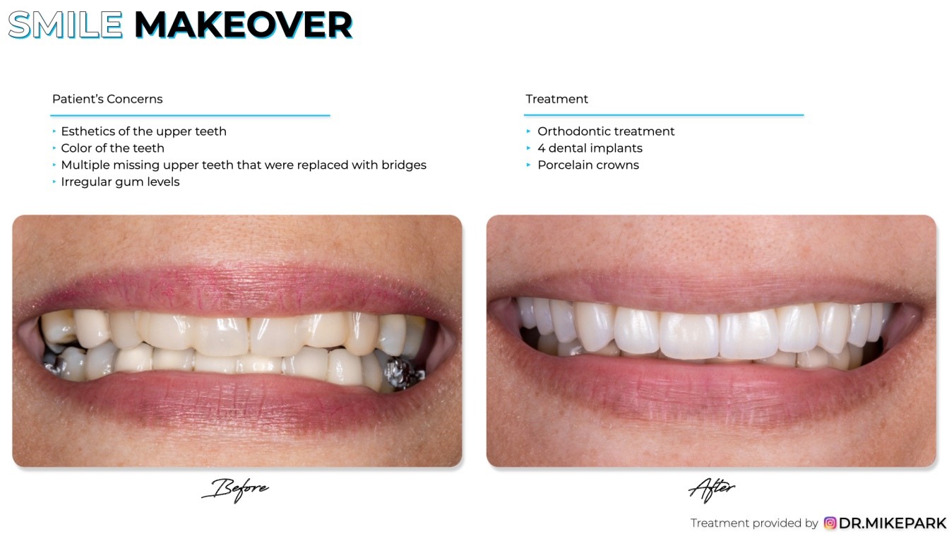 Clear-Dental_Before-and-After_019
