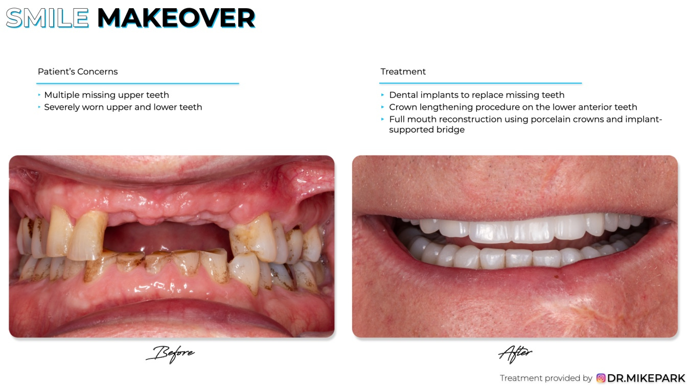 Clear-Dental_Before-and-After_022