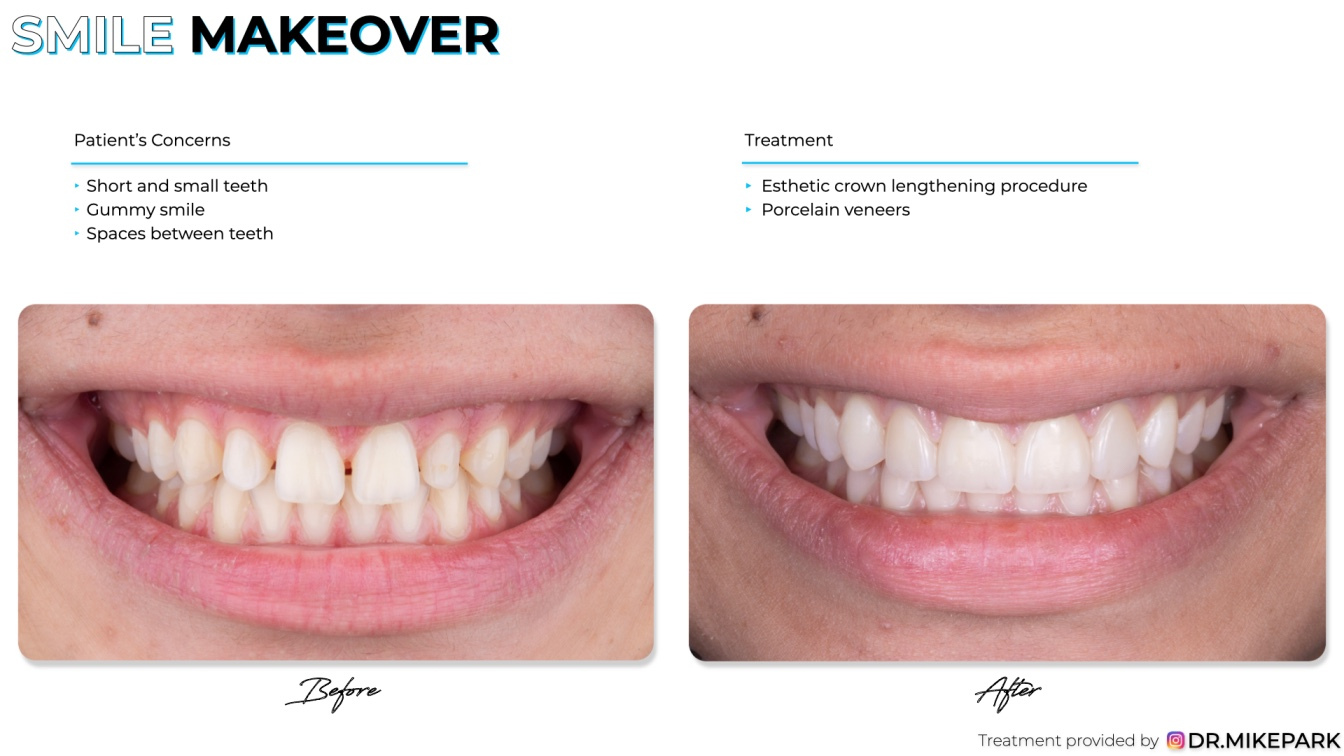 Clear-Dental_Before-and-After_004