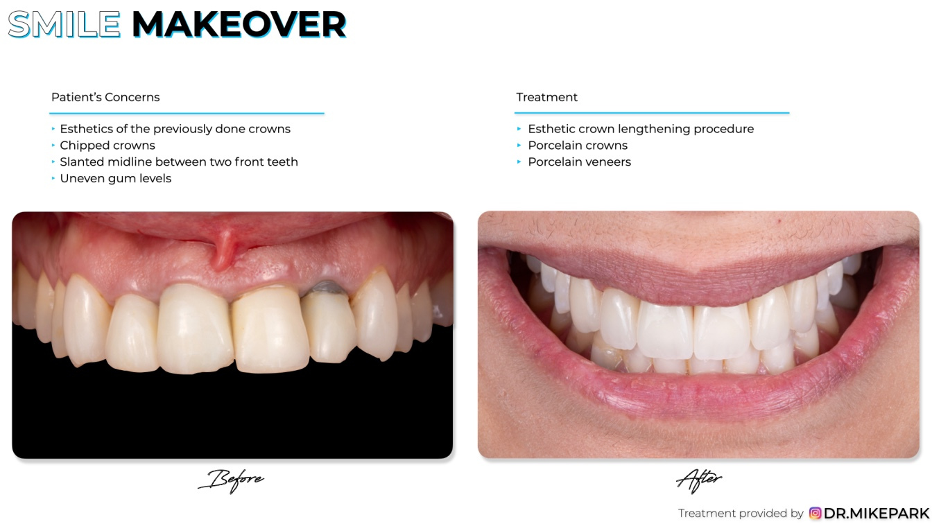 Clear-Dental_Before-and-After_008