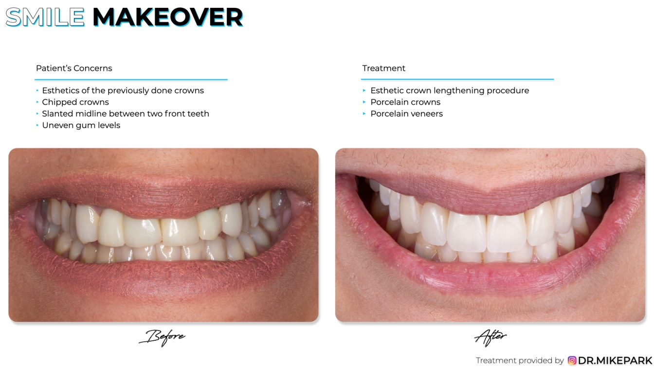 Clear-Dental_Before-and-After_009