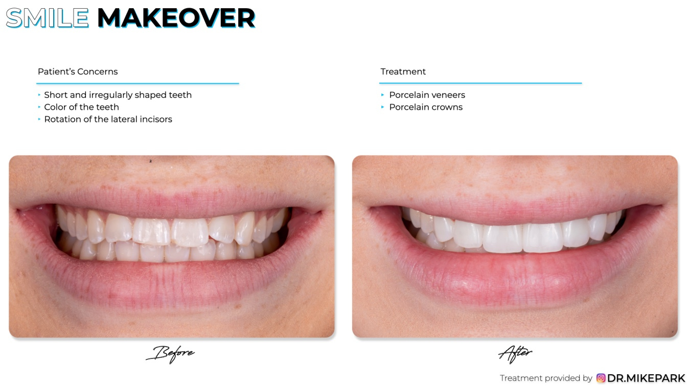 Clear-Dental_Before-and-After_011