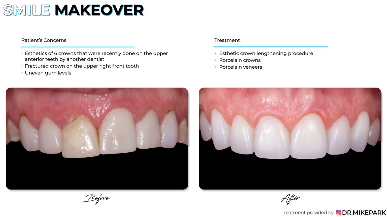 Clear-Dental_Before-and-After_028