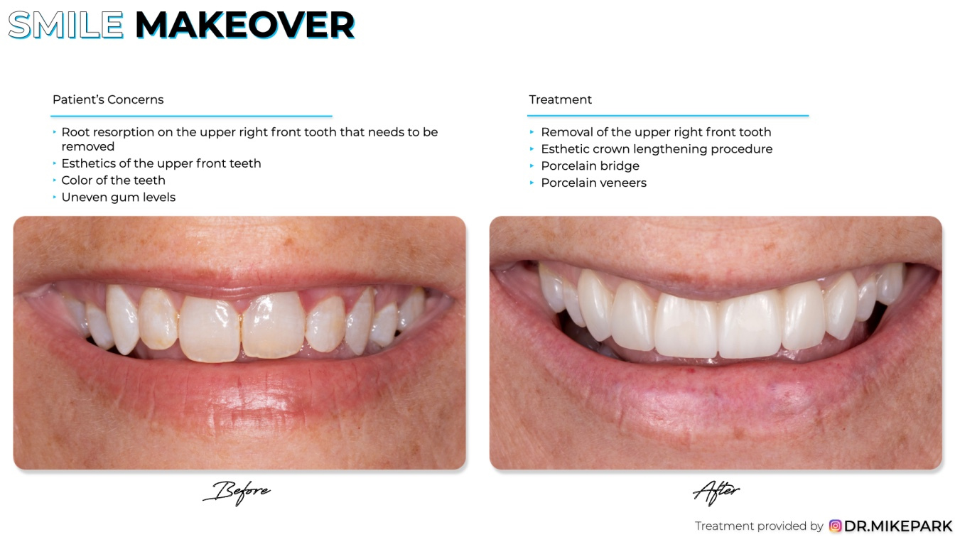 Clear-Dental_Before-and-After_029
