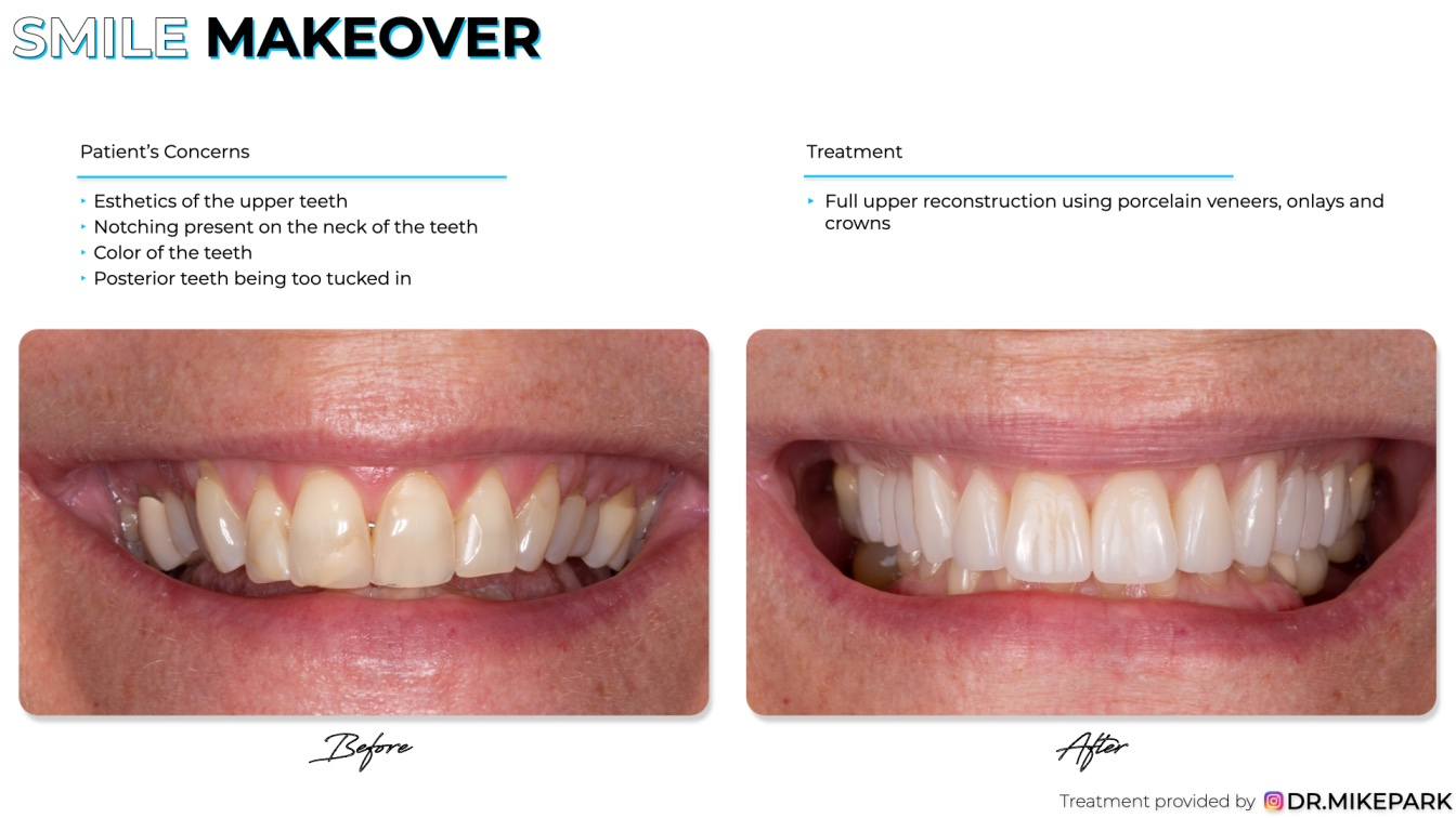 Clear-Dental_Before-and-After_030